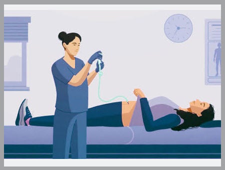 Intera pump illustration.