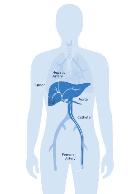 Illustration of human body showing the liver area.