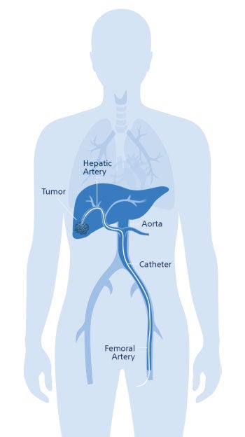 Illustration of human body showing the liver area.